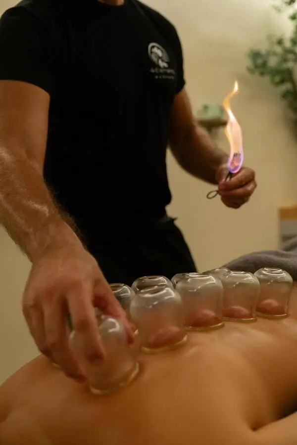 Cupping Therapy session at 4 Elements Massage Kefalonia